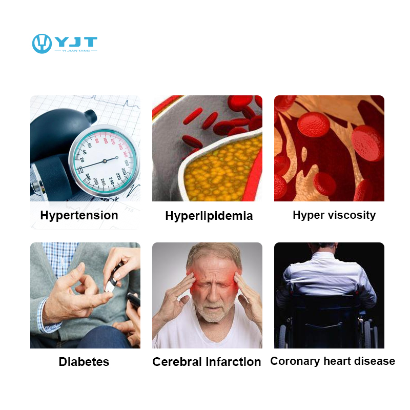 นาฬิกาอัจฉริยะ YJT OEM ODM รุ่ - Smartwatches บทวิจารณ์และราคา